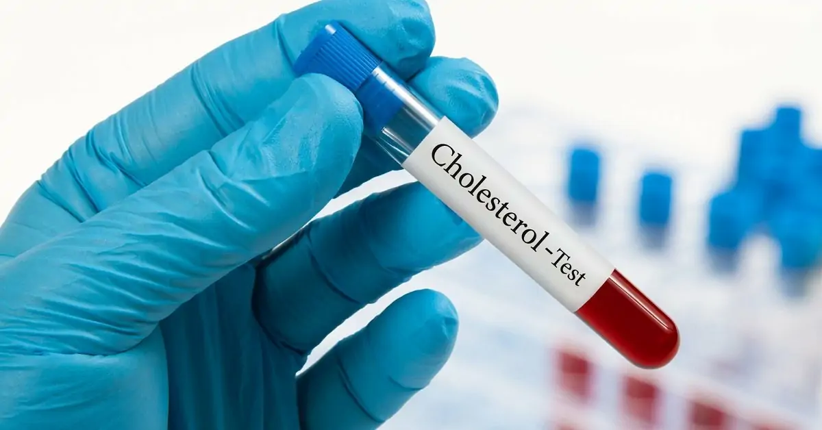 Cholesterol Test Midlands - Visit Your Nearest Knights Pharmacy Branch